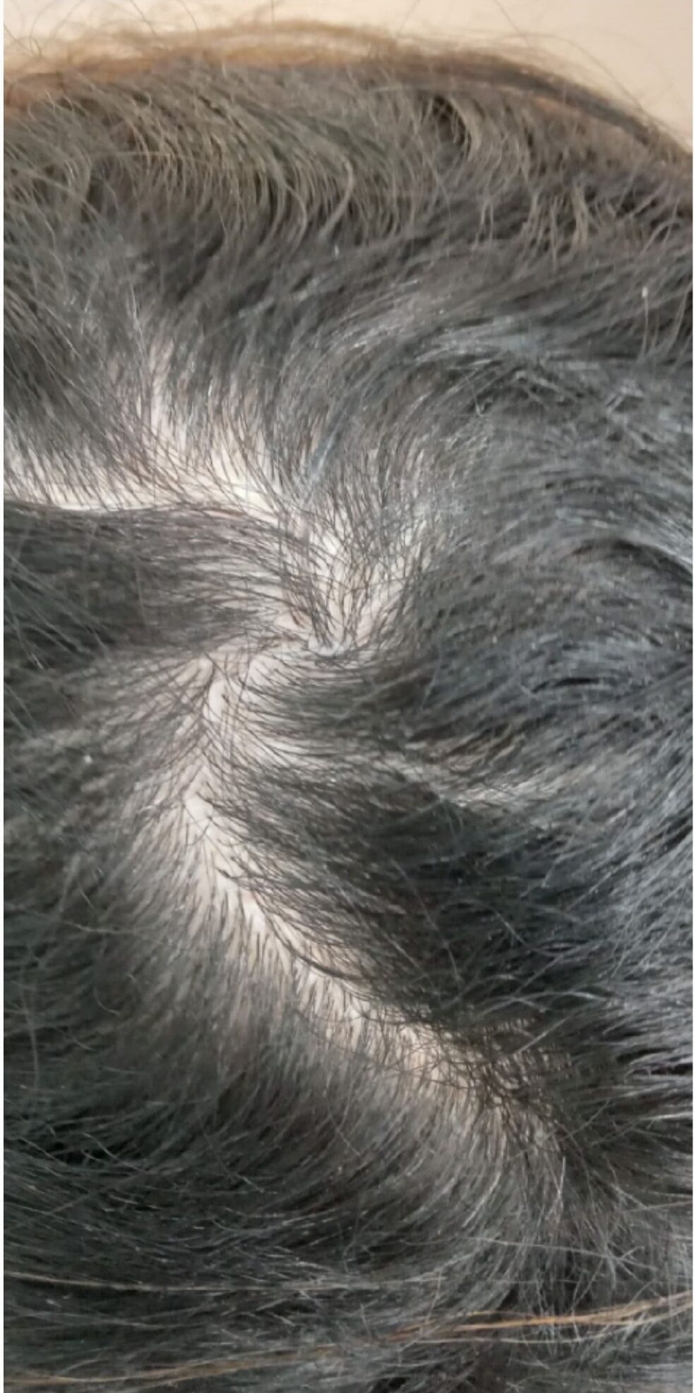 before_hair_original